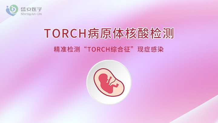 项目头图-TORCH检测.jpg